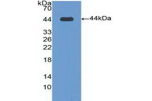 Detection of Recombinant BPI, Human using Polyclonal Antibody to Bactericidal/Permeability Increasing Protein (BPI) (BPI 抗体  (AA 140-250))