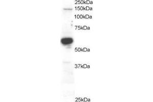 Western Blotting (WB) image for anti-Rac GTPase Activating Protein 1 (RACGAP1) (C-Term) antibody (ABIN184690)