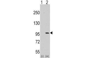 Western blot analysis of DDR1 antibody and 293 cell lysate (2 ug/lane) either nontransfected (Lane 1) or transiently transfected with the DDR1 gene (2). (DDR1 抗体  (AA 299-330))