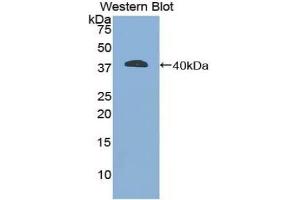 Detection of Recombinant GFAP, Mouse using Polyclonal Antibody to Glial Fibrillary Acidic Protein (GFAP) (GFAP 抗体  (AA 253-354))