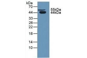 Detection of PCI in Human Urine using Polyclonal Antibody to Protein C Inhibitor (PCI) (SERPINA5 抗体  (AA 43-406))