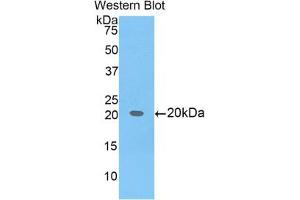 Western blot analysis of the recombinant protein. (BCL2L2 抗体  (AA 22-189))