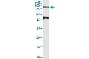 Immunoprecipitation of ARSA transfected lysate using anti-ARSA MaxPab rabbit polyclonal antibody and Protein A Magnetic Bead , and immunoblotted with ARSA purified MaxPab mouse polyclonal antibody (B01P) . (Arylsulfatase A 抗体  (AA 1-507))