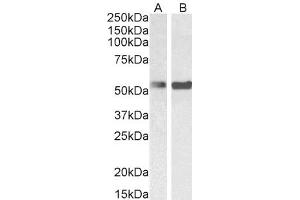 Western Blotting (WB) image for anti-Polypyrimidine Tract Binding Protein 1 (PTBP1) (N-Term) antibody (ABIN185079)