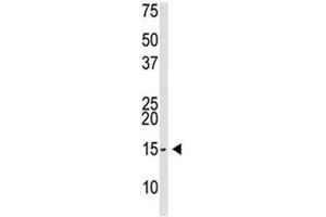 SUMO-3 antibody used in western blot to detect SUMO3 in Saos-2 cell lysate (SUMO3 抗体  (AA 38-64))