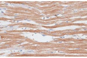 Immunohistochemistry of paraffin-embedded Rat heart using KATNA1 Polyclonal Antibody at dilution of 1:100 (40x lens). (KATNA1 抗体)