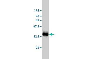 Western Blot detection against Immunogen (33. (S100A1 抗体  (AA 1-75))