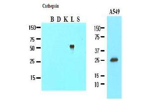Western Blotting (WB) image for anti-Cathepsin L1 (CTSL1) (AA 114-333) antibody (ABIN317508) (Cathepsin L 抗体  (AA 114-333))