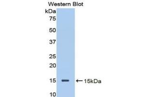 Western blot analysis of the recombinant protein. (Decorin 抗体  (AA 45-152))