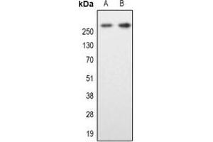 Western blot analysis of MAP2 expression in SKNSH (A), mouse brain (B) whole cell lysates. (MAP2 抗体  (N-Term))