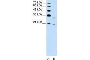 Western Blotting (WB) image for anti-Deoxyribonuclease II beta (DNASE2B) antibody (ABIN2462609) (DNASE2B 抗体)