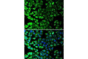 Immunofluorescence analysis of A549 cell using KRT8 antibody.