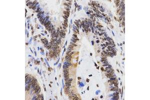 Immunohistochemistry (IHC) image for anti-Histone 3 (H3) (H3K9me2) antibody (ABIN3023260)