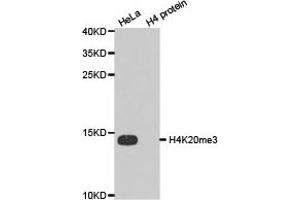 Western blot analysis of extracts of HeLa cell line and H4 protein expressed in E. (Histone 3 抗体  (3meLys20))