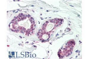 ABIN1590075 (5µg/ml) staining of paraffin embedded Human Breast. (HOXC10 抗体  (Internal Region))
