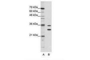Image no. 1 for anti-Methenyltetrahydrofolate Synthetase Domain Containing (MTHFSD) (AA 60-109) antibody (ABIN202358) (MTHFSD 抗体  (AA 60-109))