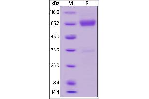 SDS-PAGE (SDS) image for Cytokine Receptor-Like Factor 2 (CRLF2) (AA 25-231) (Active) protein (Fc Tag) (ABIN6253631)
