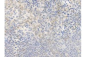 ABIN6261464 and ABIN6276554 at 1/100 staining human normal tonsil tissue by IHC-P. (EGLN1 抗体  (Internal Region))
