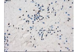 Immunohistochemical staining of paraffin-embedded Ovary tissue using anti-FCGR2A mouse monoclonal antibody. (FCGR2A 抗体)