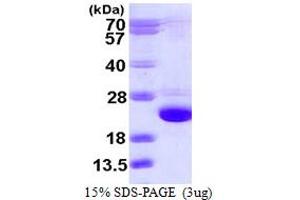 SDS-PAGE (SDS) image for Cofilin 2 (CFL2) (AA 1-166) protein (His tag) (ABIN667534) (Cofilin 2 Protein (CFL2) (AA 1-166) (His tag))