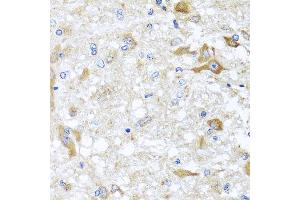 Immunohistochemistry of paraffin-embedded rat brain using ABCB8 antibody at dilution of 1:100 (x40 lens). (ABCB8 抗体)
