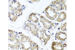 Immunohistochemistry of paraffin-embedded Human stomach using MGAT1 Polyclonal Antibody at dilution of 1:100 (40x lens). (MGAT1 抗体)