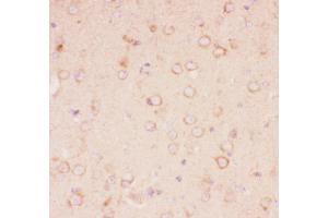 Anti-Tuberin Picoband antibody,  IHC(P): Mouse Brain Tissue (Tuberin 抗体  (AA 1611-1807))