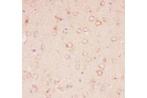 Anti-Tuberin Picoband antibody,  IHC(P): Mouse Brain Tissue (Tuberin 抗体  (AA 1611-1807))