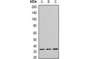 Western blot analysis of eIF2B1 expression in SHSY5Y (A), MCF7 (B), mouse liver (C), mouse brain (D) whole cell lysates. (EIF2B1 抗体)