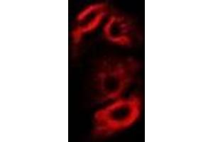 Immunofluorescent analysis of RPS10 staining in A549 cells. (RPS10 抗体)