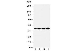 Western Blotting (WB) image for anti-Hydroxysteroid (17-Beta) Dehydrogenase 1 (HSD17B1) (AA 29-43) antibody (ABIN3031269)