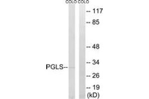 Western blot analysis of extracts from COLO cells, using PGLS Antibody. (PGLS 抗体  (AA 191-240))