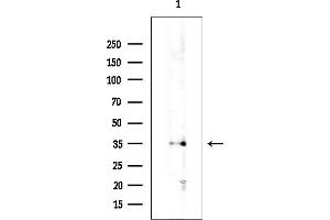 anti-Kv Channel Interacting Protein 3, Calsenilin (KCNIP3) (Internal Region) antibody