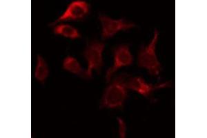 ABIN6269033 staining COS7 by IF/ICC. (TYR 抗体)