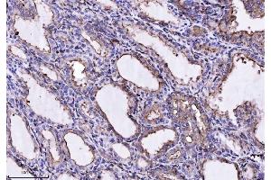 IHC analysis of Annexin-4/ANXA4 using anti-Annexin-4/ANXA4 antibody (ABIN7599265).