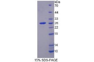 SDS-PAGE analysis of Mouse MCCC2 Protein. (MCCC2 蛋白)