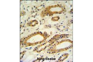 DDO Antibody IHC analysis in formalin fixed and paraffin embedded lung tissue followed by peroxidase conjugation of the secondary antibody and DAB staining. (DDO 抗体  (AA 102-130))