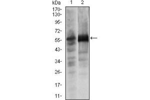 Western blot analysis using SOX9 antibody against Lovo (1) and SW620 (2) cell lysate. (SOX9 抗体)