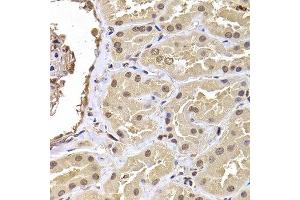 Immunohistochemistry of paraffin-embedded human kidney using RPS5 antibody at dilution of 1:100 (x400 lens). (RPS5 抗体)