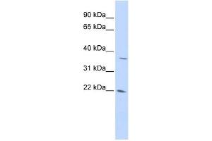 DDIT4L antibody used at 1 ug/ml to detect target protein. (DDIT4L 抗体  (Middle Region))