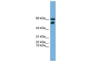 WB Suggested Anti-ZNF765 Antibody Titration: 0. (ZNF765 抗体  (N-Term))