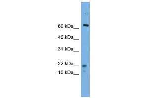 WB Suggested Anti-YPEL5 Antibody Titration: 0. (YPEL5 抗体  (N-Term))