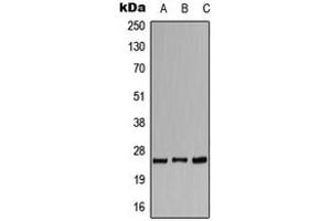 Western blot analysis of CACNG1 expression in HeLa (A), SP2/0 (B), H9C2 (C) whole cell lysates.