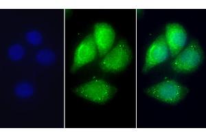 Detection of APOC1 in Human Hela cell using Polyclonal Antibody to Apolipoprotein C1 (APOC1) (APOC1 抗体  (AA 31-83))