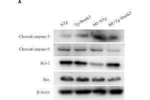 Shank3 overexpression inhibits cardiomyocytes apoptosis. (Caspase 9 抗体  (AA 1-98))