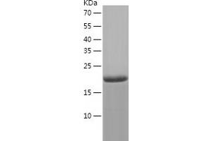 Western Blotting (WB) image for Adenosine Deaminase, tRNA-Specific 2 (ADAT2) (AA 1-191) protein (His tag) (ABIN7121708) (ADAT2 Protein (AA 1-191) (His tag))
