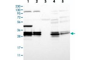 Western blot analysis of Lane 1: RT-4, Lane 2: U-251 MG, Lane 3: Human Plasma, Lane 4: Liver, Lane 5: Tonsil with PGAM5 polyclonal antibody  at 1:500-1:1000 dilution. (PGAM5 抗体)