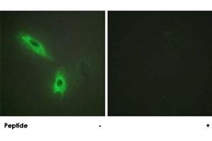Immunofluorescence analysis of HeLa cells, using LTB polyclonal antibody . (LTB 抗体  (C-Term))