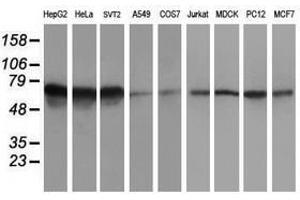 Image no. 2 for anti-5-Aminoimidazole-4-Carboxamide Ribonucleotide Formyltransferase/IMP Cyclohydrolase (ATIC) antibody (ABIN1496505) (ATIC 抗体)