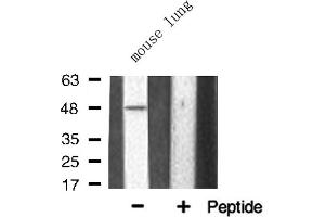 Western blot analysis of TNF Receptor II expression in Mouse lung lysate (TNFRSF1B 抗体  (C-Term))